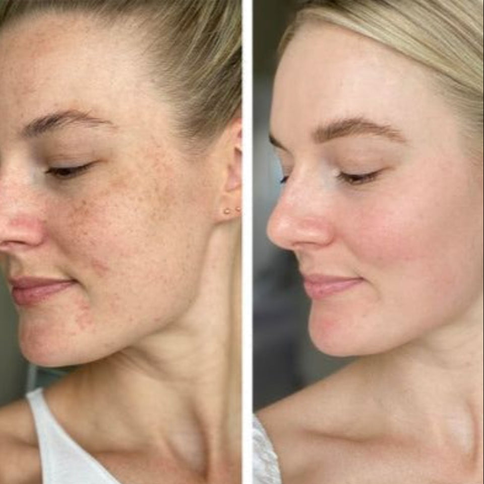 Masque LED Miracle